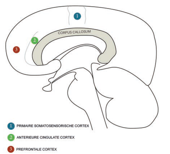 Doorsnede van de hersenen met daarop de anatomische regio’s betrokken in het pijnproces. Bovenaan de mid-sagittale doorsnede en onderaan de coronale doorsnede