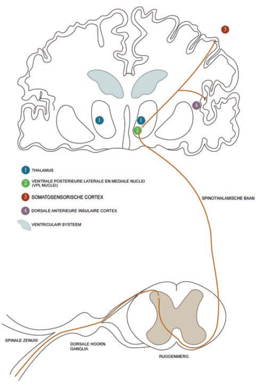 Figuur 3: Schematische schets van de primaire somatosensore baan. De perifere zenuw schakelt in het dorsale gedeelte van het ruggenmerg. Vervolgens verloopt het opstijgende axon via de spinothalamische baan naar de thalamus en schakelt in de VPL-kern van de thalamus met projecties naar de primaire somatosensorische cortex en naar de insulaire cortex.